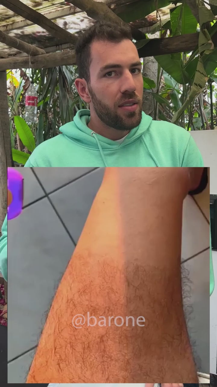 ¡DEPILADORA LÁSER PORTÁTIL! -  ¡DILE ADIOS AL VELLO SOBRANTE!